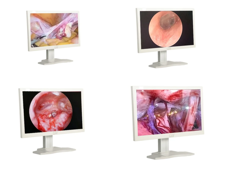 HD Endoscope Camera System Medical Equipment with CE for Endoscopy
